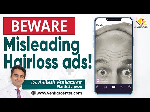 How misleading hairloss products ads on social media can affect your health! Venkat Center Bengaluru