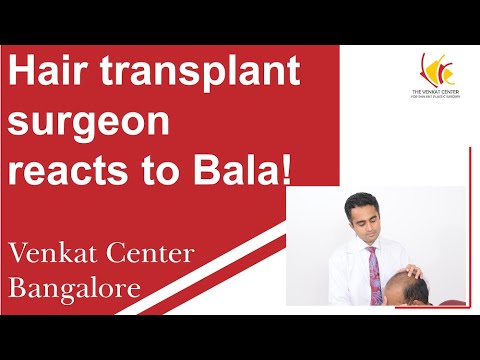 Hair transplant surgeon reacts to Bala! Venkat Center Bangalore