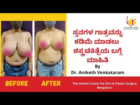 Breast Reduction Surgery Cost In India