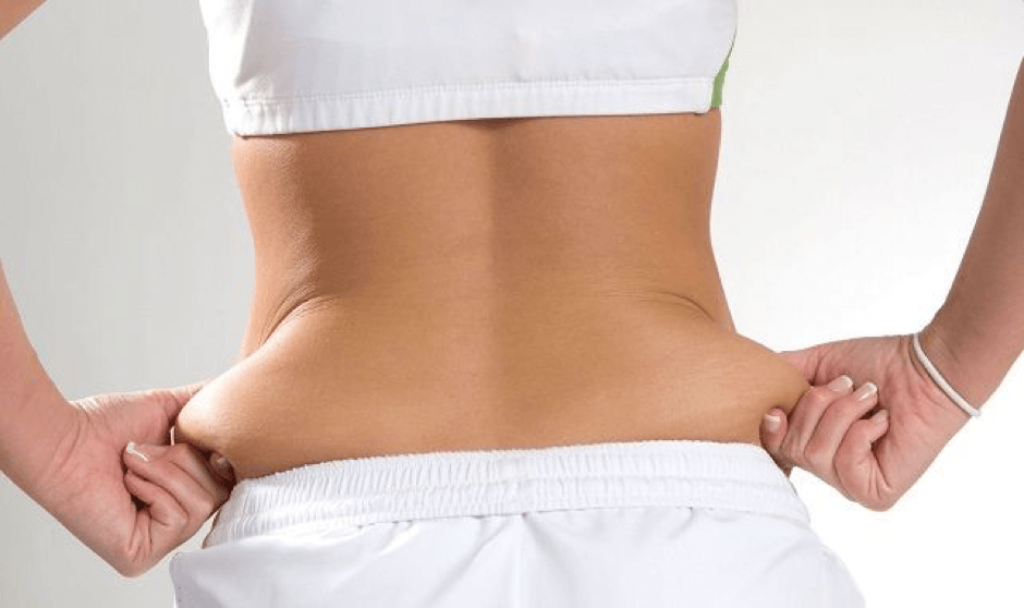 Liposuction In Abdomen- Abdominal Surgery At Venkat Center