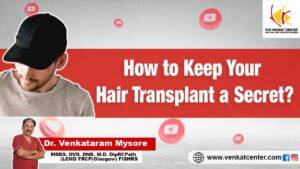 Hair Transplant